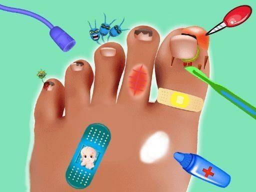 Nail Doctor Surgery Game